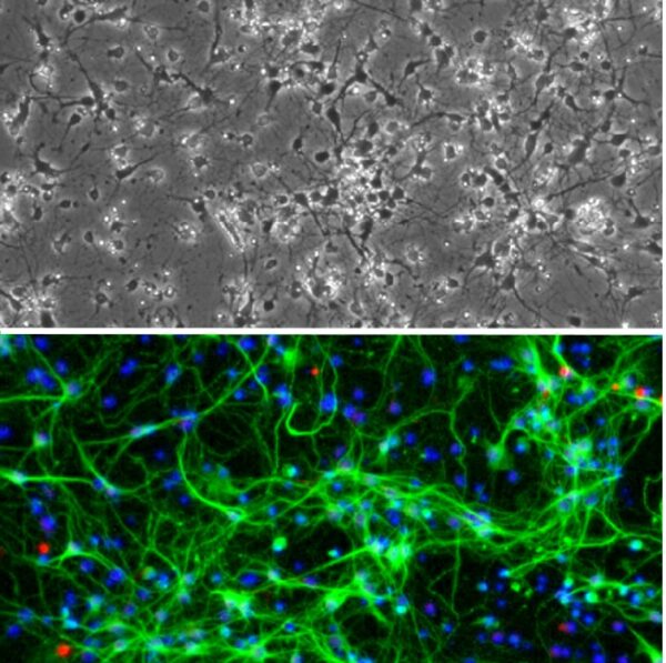 Rat Hindbrain Neurons: RHbN