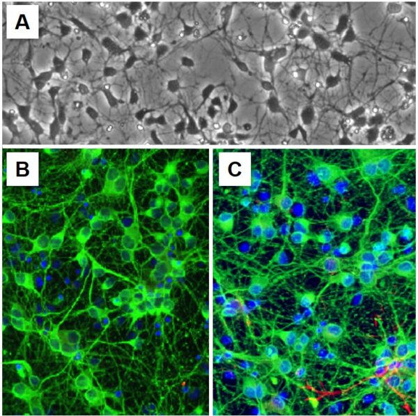 Rat Hippocampal Neurons: RHiN