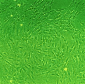 Rat Lung Fibroblasts: RLF