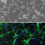 Rat Striatal Neurons: RStN