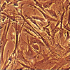Rabbit Aortic Smooth Muscle Cells: RbAOSMC