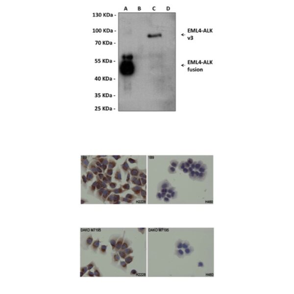 Anti-ALK: Mouse ALK Antibody