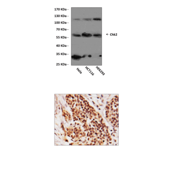 Anti-Chk2: Mouse Chk2 Antibody