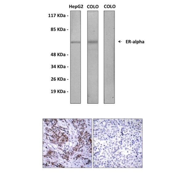 Anti-ERα: Rabbit ERα Antibody