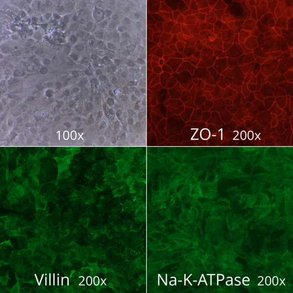 Ulcerative Colitis Gastrointestinal Epithelial Cells, Naive