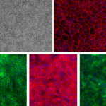 Human Jejunum Epithelial Cells: HJeEpC