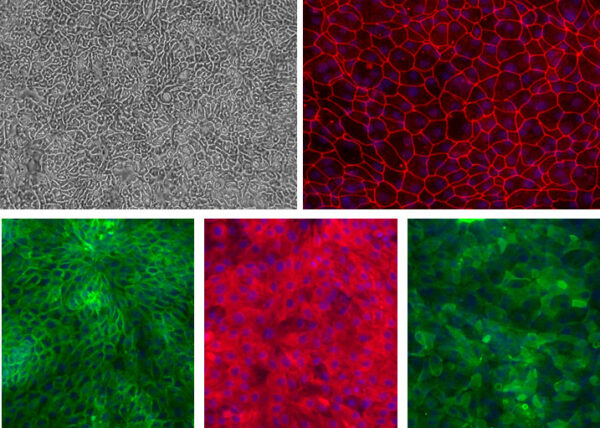 Human Jejunum Epithelial Cells: HJeEpC