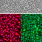 Human Small Airway Epithelial Cells: Asthma: HSAEpC-AS