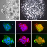 Human iPSC-derived Alveolar Epithelial Cells: AEC2 / i-HAEpC2