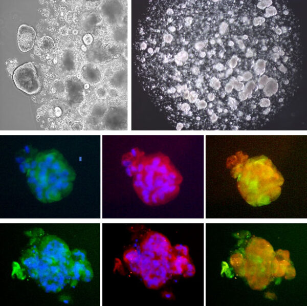 Human iPSC-derived Alveolar Epithelial Cells: AEC2 / i-HAEpC2