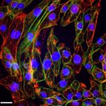 Human iPSC-Derived Cardiac Cells: i-HCm