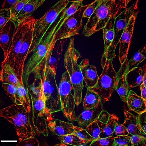 Human iPSC-Derived Cardiac Cells: i-HCm