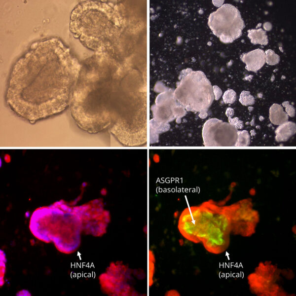 Human iPSC-Derived Hepatocytes: i-HH