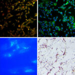 Human iPSC-Derived Hepatic Stellate Cells: i-HHSC