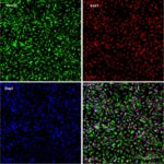 Human iPSC-Derived Neural Stem Cells: i-HNSC