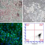 Human iPSC-Derived Brown Fat Preadipocytes: i-HBrPAd