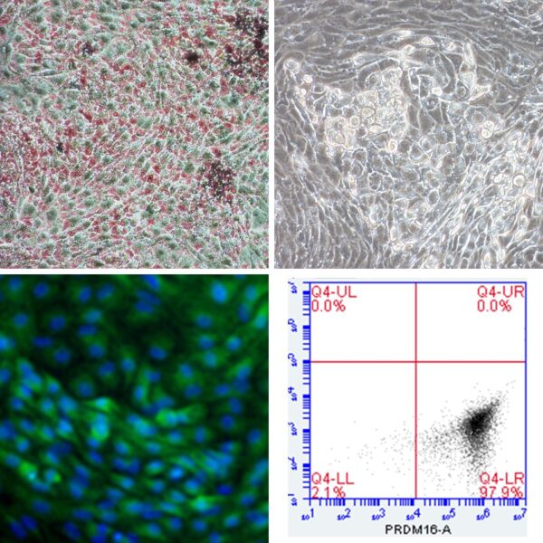 iPSC-derived-Brown-Fat-Preadipocytes-i-HBrPAd