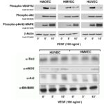 Human Aortic Endothelial Cells: S-HAOEC: Pre-Screened