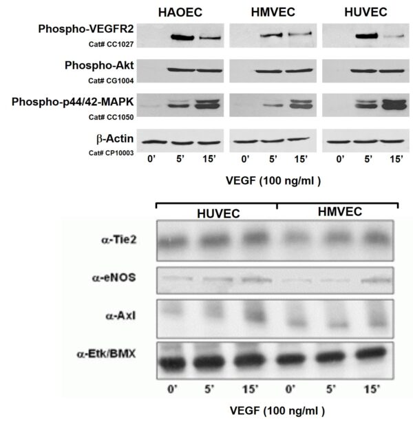 Human Umbilical Vein Endothelial Cells: S-HUVEC: Pre-Screened