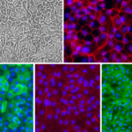 Human Colon Epithelial Cells: HCnEpC