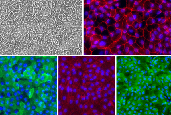 Human Colon Epithelial Cells: HCnEpC