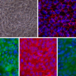 Human Gastric Epithelial Cells: HGaEpC