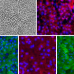 Human Intestinal Epithelial Cells: HInEpC