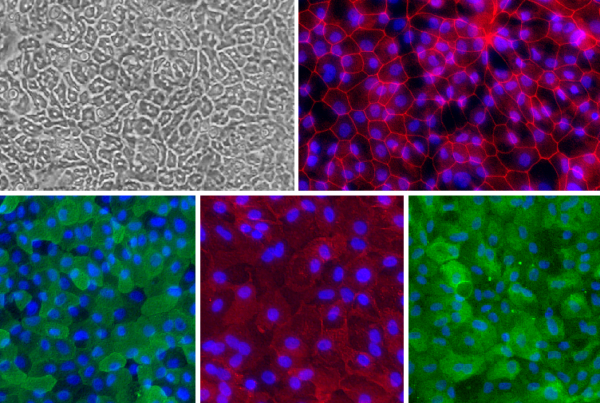 Human Intestinal Epithelial Cells: HInEpC