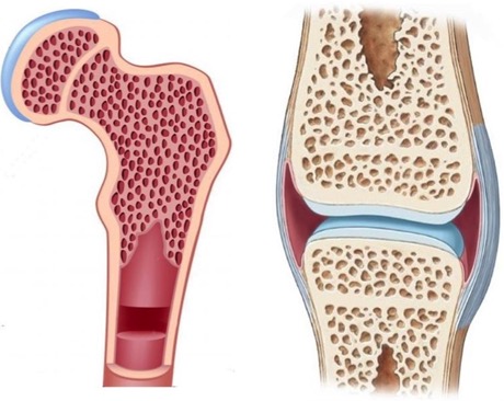 Bone