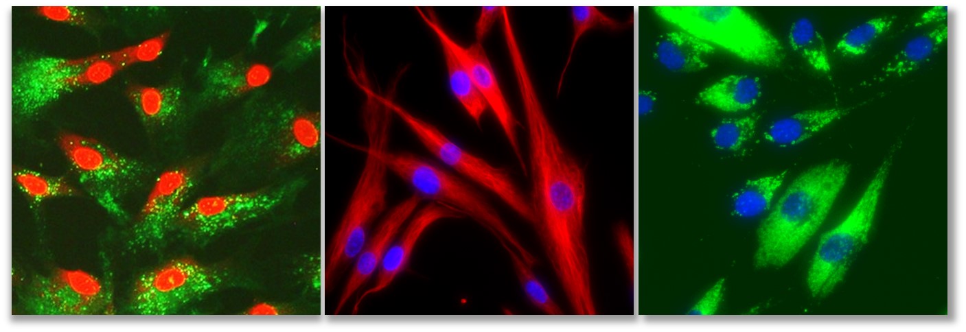 Fibroblast