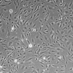 Human Aortic Endothelial Cells: Asthma: HAOEC-AS