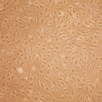 Human Aortic Endothelial Cells: Type 2 Diabetes: HAOEC-T2D