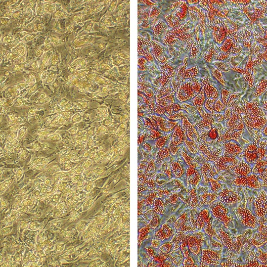 Adipocyte