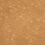 Human Bronchial Epithelial Cells: Asthma: HBEpC-AS