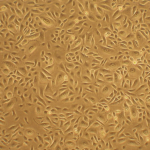 Human Bronchial Epithelial Cells: COPD: HBEpC-COPD