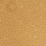 Human Brachiocephalic Artery Endothelial Cells: Type 2 Diabetes: HBcAEC-T2D