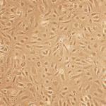 Human Coronary Artery Endothelial Cells: Asthma HCAEC-AS