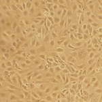 Human Coronary Artery Endothelial Cells: Type 2 Diabetes: HCAEC-T2D