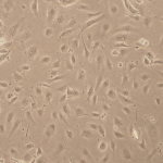 Human Carotid Artery Endothelial Cells: Asthma: HCtAEC-AS