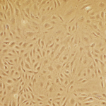 Human Lung Microvascular Endothelial Cells: Asthma: HLMVEC-AS