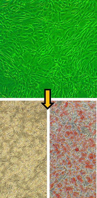 Preadipocyte