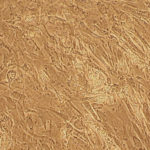 Human Preadipocytes: Type 2 Diabetes: HPAd-T2D