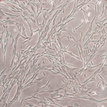 Human Skeletal Muscle Cells: Type 2 Diabetes: HSkMC-T2D