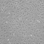 Human Tracheal Epithelial Cells: Asthma: HTEpC-AS