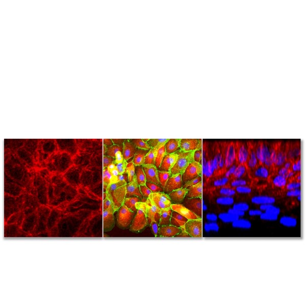 Keratinocyte