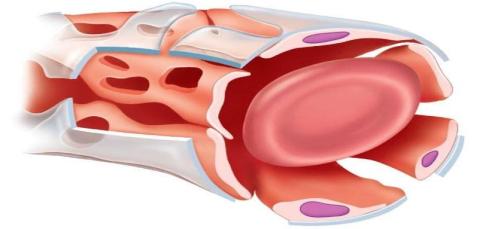 Microvascular