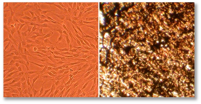 Osteoblast