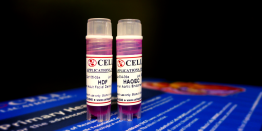 Primary Cells