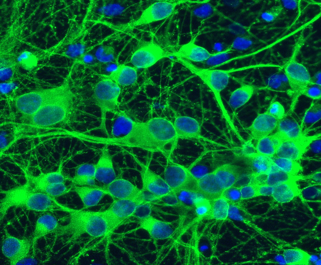 Neuron
