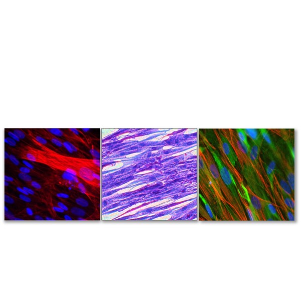 Skeletal Muscle